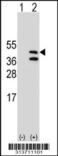 Western blot analysis of his-tag NDUFAF1 (arrow) using his tag antibody. 293 cell lysates (2 ug/lane) either nontransfected (Lane 1) or transiently transfected with the NDUFAF1 gene