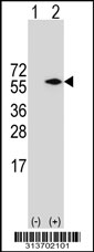 Western blot analysis of his-tag ARC (arrow) using his tag antibody. 293 cell lysates (2 ug/lane) either nontransfected (Lane 1) or transiently transfected with the ARC gene