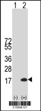 Western blot analysis of his-tag DOLPP1 (arrow) using his tag antibody. 293T cell lysates (2 ug/lane) either nontransfected (Lane 1) or transiently transfected with the DOLPP1 gene‘
