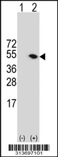 Western blot analysis of his-tag LPXN (arrow) using his tag antibody. 293 cell lysates (2 ug/lane) either nontransfected (Lane 1) or transiently transfected with the LPXN gene