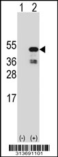 Western blot analysis of his-tag CCDC94 (arrow) using his tag antibody. 293 cell lysates (2 ug/lane) either nontransfected (Lane 1) or transiently transfected with the CCDC94 gene