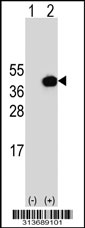 Western blot analysis of his-tag FSTL1 (arrow) using his tag antibody. 293 cell lysates (2 ug/lane) either nontransfected (Lane 1) or transiently transfected with the FSTL1 gene