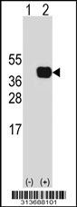 Western blot analysis of his-tag RIMS3 (arrow) using his tag antibody. 293 cell lysates (2 ug/lane) either nontransfected (Lane 1) or transiently transfected with the RIMS3 gene