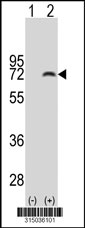 Western blot analysis of his-tag C1orf92 (arrow) using his tag antibody. 293T cell lysates (2 ug/lane) either nontransfected (Lane 1) or transiently transfected with the C1orf92 gene‘