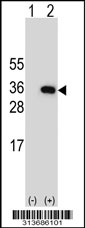 Western blot analysis of his-tag HOXB13 (arrow) using his tag antibody. 293 cell lysates (2 ug/lane) either nontransfected (Lane 1) or transiently transfected with the HOXB13 gene