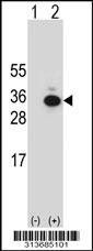 Western blot analysis of his-tag SLA (arrow) using his tag antibody. 293 cell lysates (2 ug/lane) either nontransfected (Lane 1) or transiently transfected with the SLA gene