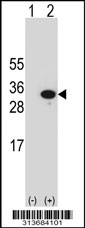 Western blot analysis of his-tag PROSC (arrow) using his tag antibody. 293 cell lysates (2 ug/lane) either nontransfected (Lane 1) or transiently transfected with the PROSC gene