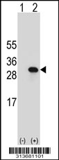 Western blot analysis of his-tag PRDX4 (arrow) using his tag antibody. 293 cell lysates (2 ug/lane) either nontransfected (Lane 1) or transiently transfected with the PRDX4 gene