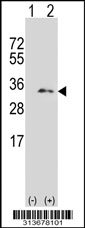 Western blot analysis of his-tag PSMA1 (arrow) using his tag antibody. 293 cell lysates (2 ug/lane) either nontransfected (Lane 1) or transiently transfected with the PSMA1 gene