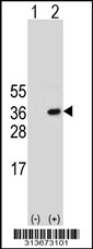 Western blot analysis of his-tag PSMA3 (arrow) using his tag antibody. 293 cell lysates (2 ug/lane) either nontransfected (Lane 1) or transiently transfected with the PSMA3 gene
