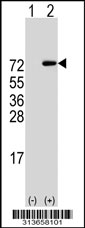 Western blot analysis of his-tag APEH (arrow) using his tag antibody. 293 cell lysates (2 ug/lane) either nontransfected (Lane 1) or transiently transfected with the APEH gene