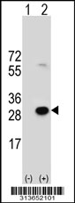 Western blot analysis of his-tag LDHAL6A (arrow) using his tag antibody. 293 cell lysates (2 ug/lane) either nontransfected (Lane 1) or transiently transfected with the LDHAL6A gene