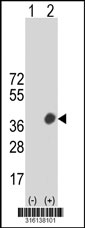 Western blot analysis of his-tag PTPRCAP (arrow) using his tag antibody. 293T cell lysates (2 ug/lane) either nontransfected (Lane 1) or transiently transfected with the PTPRCAP gene‘