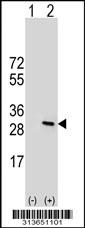 Western blot analysis of his-tag DIRAS3 (arrow) using his tag antibody. 293 cell lysates (2 ug/lane) either nontransfected (Lane 1) or transiently transfected with the DIRAS3 gene