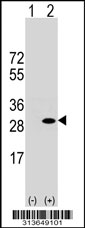 Western blot analysis of his-tag RPE (arrow) using his tag antibody. 293 cell lysates (2 ug/lane) either nontransfected (Lane 1) or transiently transfected with the RPE gene