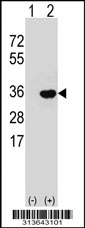 Western blot analysis of his-tag UBE2S (arrow) using his tag antibody. 293 cell lysates (2 ug/lane) either nontransfected (Lane 1) or transiently transfected with the UBE2S gene
