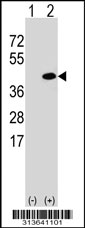 Western blot analysis of his-tag POLR3GL (arrow) using his tag antibody. 293 cell lysates (2 ug/lane) either nontransfected (Lane 1) or transiently transfected with the POLR3GL gene