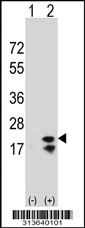 Western blot analysis of his-tag TSPAN2 (arrow) using his tag antibody. 293 cell lysates (2 ug/lane) either nontransfected (Lane 1) or transiently transfected with the TSPAN2 gene