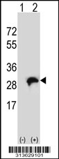 Western blot analysis of his-tag PPCDC (arrow) using his tag antibody. 293 cell lysates (2 ug/lane) either nontransfected (Lane 1) or transiently transfected with the PPCDC gene