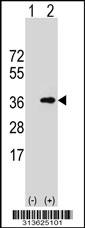 Western blot analysis of his-tag CHMP6 (arrow) using his tag antibody. 293 cell lysates (2 ug/lane) either nontransfected (Lane 1) or transiently transfected with the CHMP6 gene