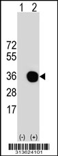Western blot analysis of his-tag CHMP1B (arrow) using his tag antibody. 293 cell lysates (2 ug/lane) either nontransfected (Lane 1) or transiently transfected with the CHMP1B gene