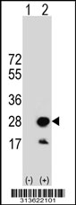Western blot analysis of his-tag ARMC7 (arrow) using his tag antibody. 293 cell lysates (2 ug/lane) either nontransfected (Lane 1) or transiently transfected with the ARMC7 gene