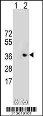 Western blot analysis of his-tag CCDC53 (arrow) using his tag antibody. 293 cell lysates (2 ug/lane) either nontransfected (Lane 1) or transiently transfected with the CCDC53 gene
