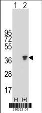 Western blot analysis of his-tag RAET1E (arrow) using his tag antibody. 293T cell lysates (2 ug/lane) either nontransfected (Lane 1) or transiently transfected with the RAET1E gene‘