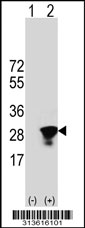 Western blot analysis of his-tag RNF183 (arrow) using his tag antibody. 293 cell lysates (2 ug/lane) either nontransfected (Lane 1) or transiently transfected with the RNF183 gene