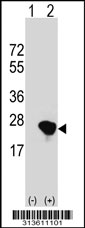 Western blot analysis of his-tag TRIML1 (arrow) using his tag antibody. 293 cell lysates (2 ug/lane) either nontransfected (Lane 1) or transiently transfected with the TRIML1 gene