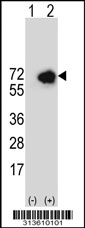 Western blot analysis of his-tag TGFBI (arrow) using his tag antibody. 293 cell lysates (2 ug/lane) either nontransfected (Lane 1) or transiently transfected with the TGFBI gene