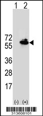 Western blot analysis of his-tag ACAD9 (arrow) using his tag antibody. 293 cell lysates (2 ug/lane) either nontransfected (Lane 1) or transiently transfected with the ACAD9 gene