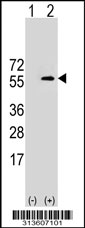 Western blot analysis of his-tag SHMT2 (arrow) using his tag antibody. 293 cell lysates (2 ug/lane) either nontransfected (Lane 1) or transiently transfected with the SHMT2 gene