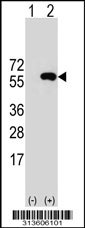 Western blot analysis of his-tag SUFU (arrow) using his tag antibody. 293 cell lysates (2 ug/lane) either nontransfected (Lane 1) or transiently transfected with the SUFU gene