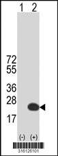 Western blot analysis of his-tag LCN8 (arrow) using his tag antibody. 293T cell lysates (2 ug/lane) either nontransfected (Lane 1) or transiently transfected with the LCN8 gene‘