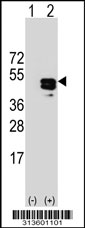 Western blot analysis of his-tag STOML2 (arrow) using his tag antibody. 293 cell lysates (2 ug/lane) either nontransfected (Lane 1) or transiently transfected with the STOML2 gene