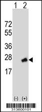 Western blot analysis of his-tag LMBRD1 (arrow) using his tag antibody. 293 cell lysates (2 ug/lane) either nontransfected (Lane 1) or transiently transfected with the LMBRD1 gene