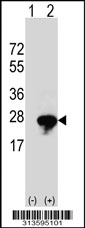 Western blot analysis of his-tag CHAC2 (arrow) using his tag antibody. 293 cell lysates (2 ug/lane) either nontransfected (Lane 1) or transiently transfected with the CHAC2 gene