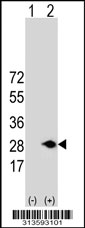 Western blot analysis of his-tag RAP1A (arrow) using his tag antibody. 293 cell lysates (2 ug/lane) either nontransfected (Lane 1) or transiently transfected with the RAP1A gene