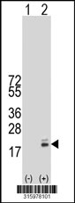 Western blot analysis of his-tag LCN6 (arrow) using his tag antibody. 293T cell lysates (2 ug/lane) either nontransfected (Lane 1) or transiently transfected with the LCN6 gene‘