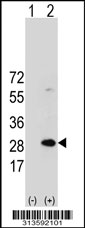 Western blot analysis of his-tag RPL17 (arrow) using his tag antibody. 293 cell lysates (2 ug/lane) either nontransfected (Lane 1) or transiently transfected with the RPL17 gene