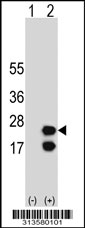 Western blot analysis of his-tag ISCU (arrow) using his tag antibody. 293 cell lysates (2 ug/lane) either nontransfected (Lane 1) or transiently transfected with the ISCU gene