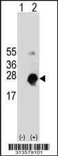 Western blot analysis of his-tag FAM163A (arrow) using his tag antibody. 293 cell lysates (2 ug/lane) either nontransfected (Lane 1) or transiently transfected with the FAM163A gene
