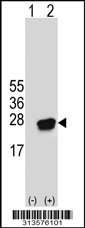 Western blot analysis of his-tag C15orf15 (arrow) using his tag antibody. 293 cell lysates (2 ug/lane) either nontransfected (Lane 1) or transiently transfected with the C15orf15 gene