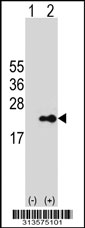 Western blot analysis of his-tag FAM96B (arrow) using his tag antibody. 293 cell lysates (2 ug/lane) either nontransfected (Lane 1) or transiently transfected with the FAM96B gene