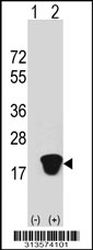 Western blot analysis of his-tag PPIL1 (arrow) using his tag antibody. 293 cell lysates (2 ug/lane) either nontransfected (Lane 1) or transiently transfected with the PPIL1 gene