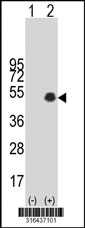 Western blot analysis of his-tag SP6 (arrow) using his tag antibody. 293T cell lysates (2 ug/lane) either nontransfected (Lane 1) or transiently transfected with the SP6 gene‘