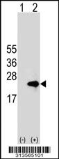 Western blot analysis of his-tag UXT (arrow) using his tag antibody. 293 cell lysates (2 ug/lane) either nontransfected (Lane 1) or transiently transfected with the UXT gene