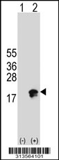 Western blot analysis of his-tag ORMDL2 (arrow) using his tag antibody. 293 cell lysates (2 ug/lane) either nontransfected (Lane 1) or transiently transfected with the ORMDL2 gene