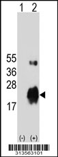 Western blot analysis of his-tag FAM176A (arrow) using his tag antibody. 293 cell lysates (2 ug/lane) either nontransfected (Lane 1) or transiently transfected with the FAM176A gene